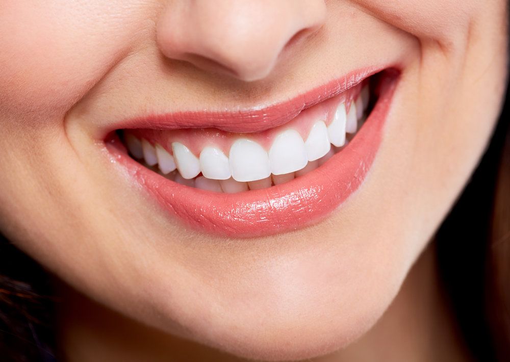 Consejos para mantener tu sonrisa después de corregir el apiñamiento dental